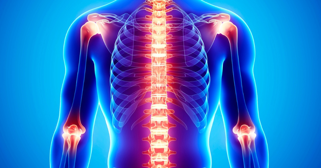 top 10 natural remedies to reduce chronic back and joint pain relief